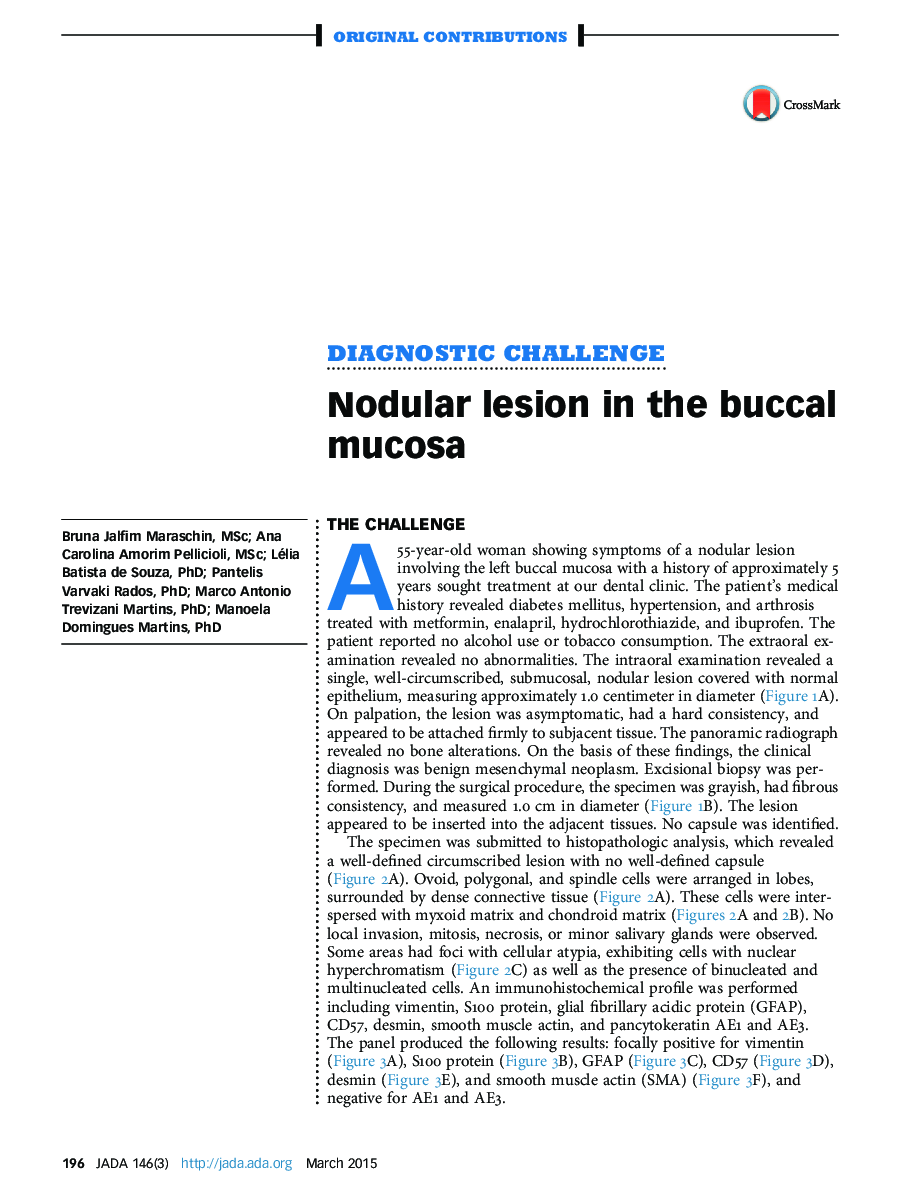 Nodular lesion in the buccal mucosa