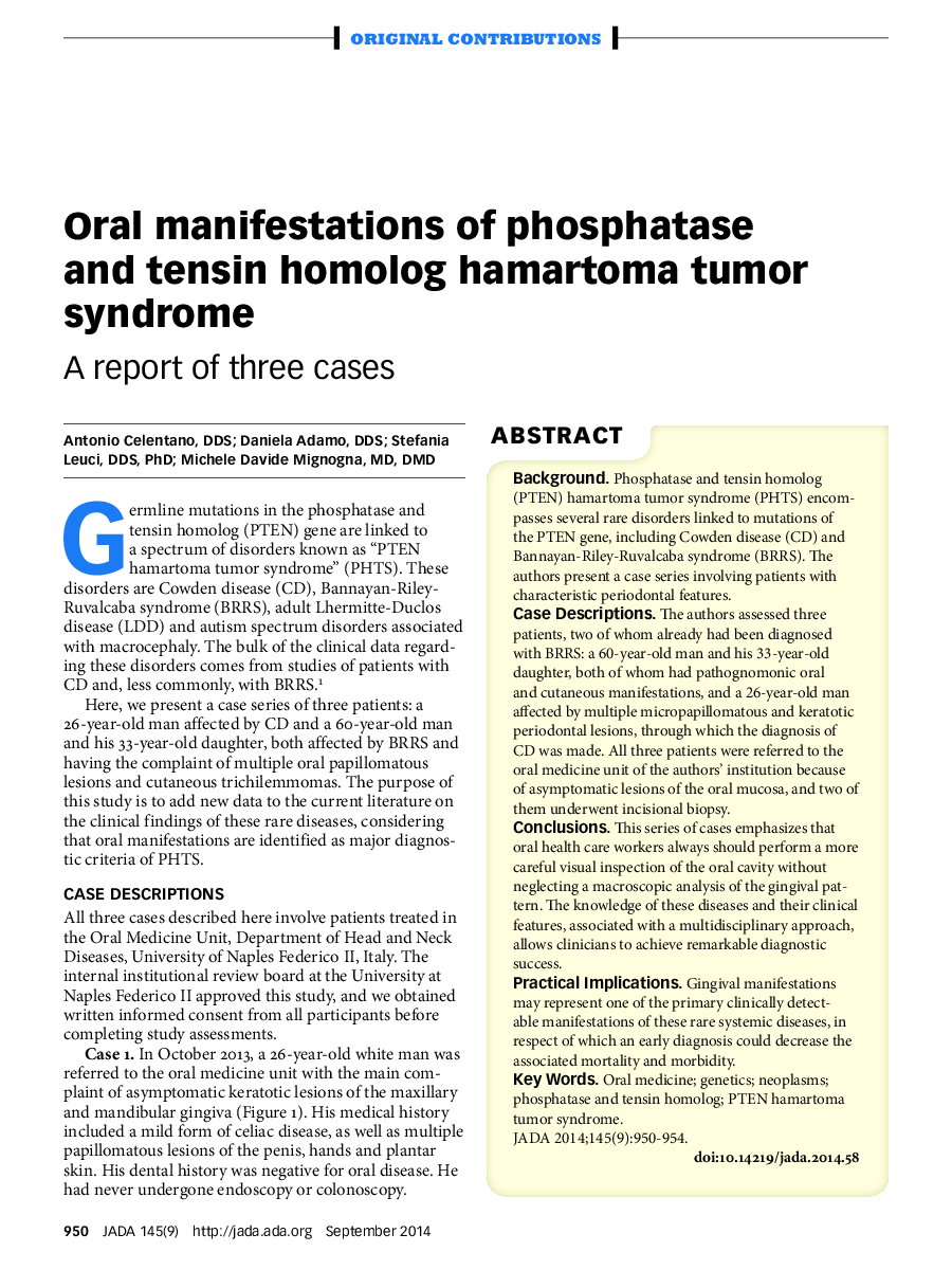 Oral manifestations of phosphatase and tensin homolog hamartoma tumor syndrome : A report of three cases