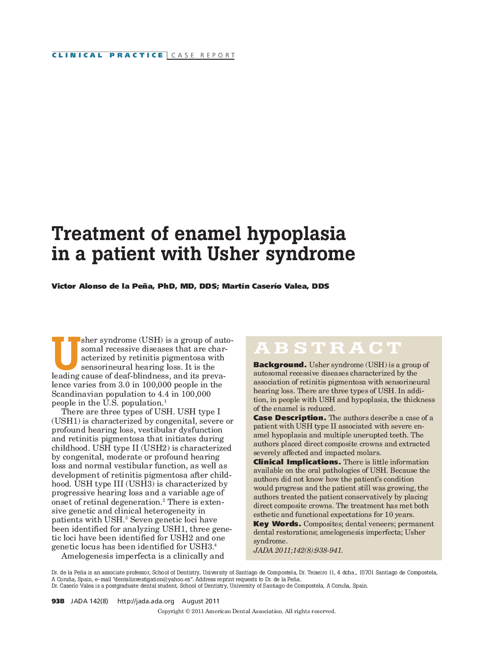 Treatment of enamel hypoplasia in a patient with Usher syndrome 