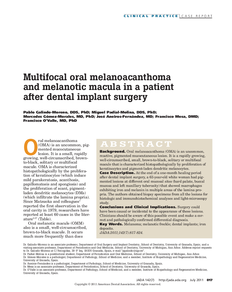 Multifocal oral melanoacanthoma and melanotic macula in a patient after dental implant surgery 