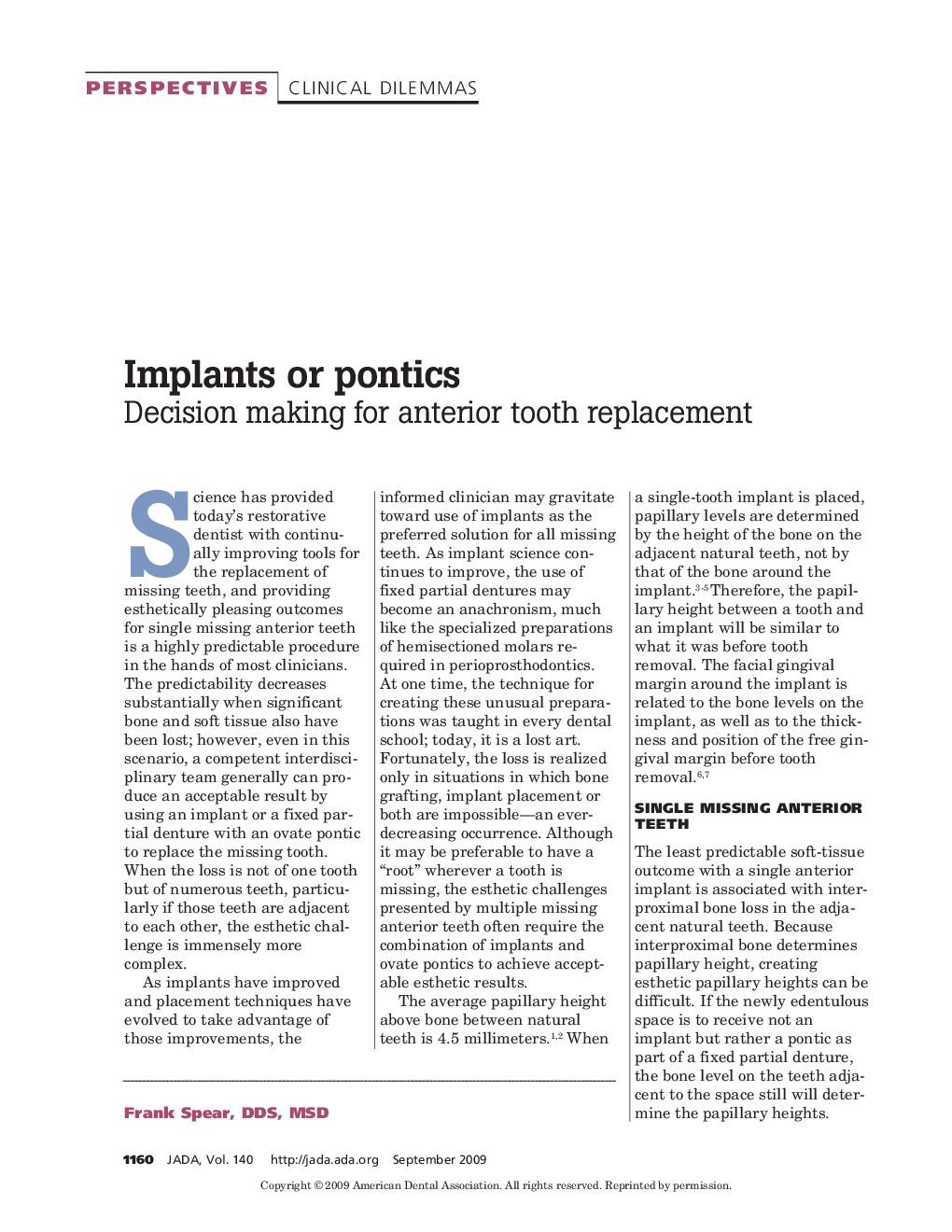 Implants or Pontics