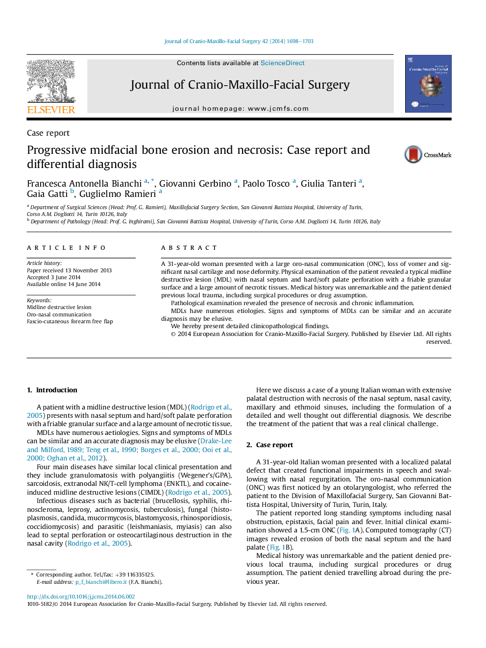 Progressive midfacial bone erosion and necrosis: Case report and differential diagnosis