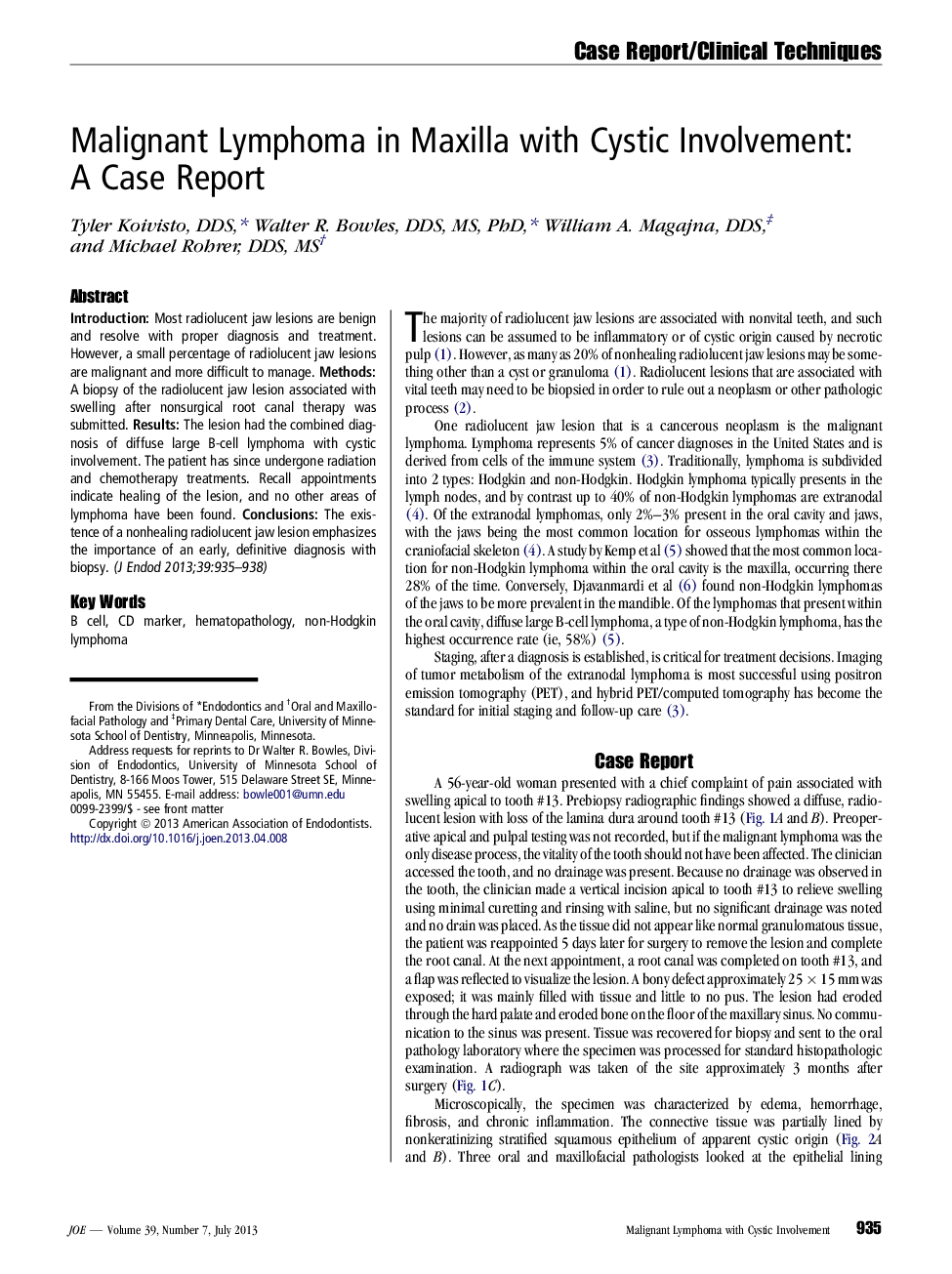 Malignant Lymphoma in Maxilla with Cystic Involvement: A Case Report