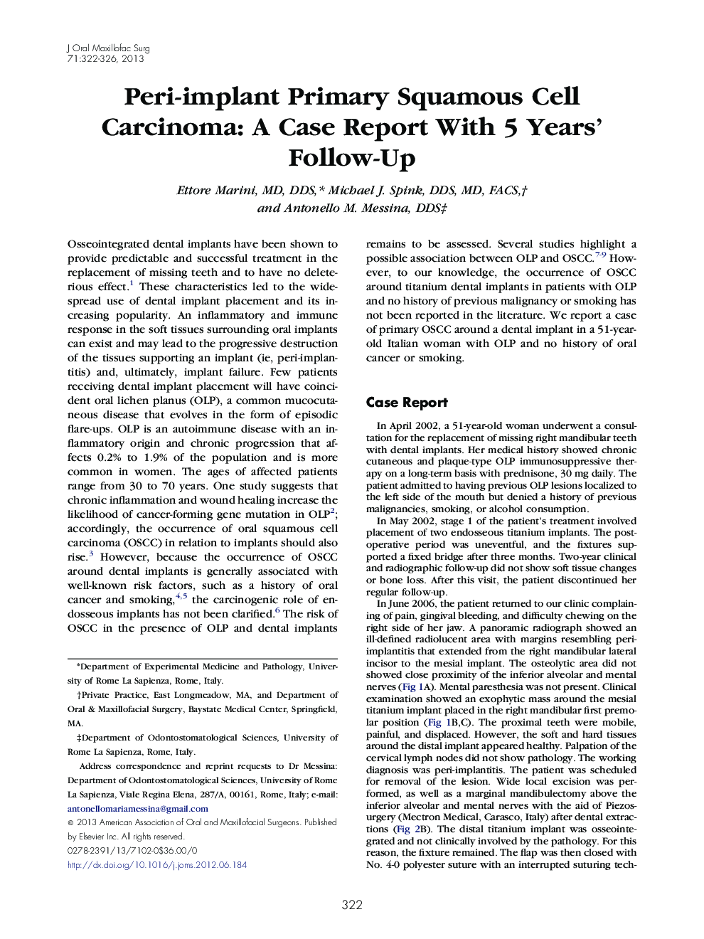 Peri-implant Primary Squamous Cell Carcinoma: A Case Report With 5 Years' Follow-Up