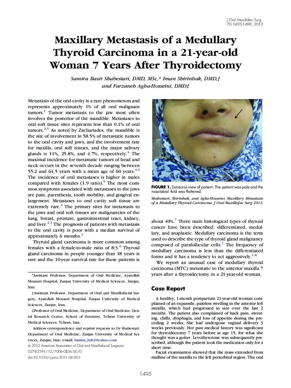 Maxillary Metastasis of a Medullary Thyroid Carcinoma in a 21-year-old Woman 7 Years After Thyroidectomy