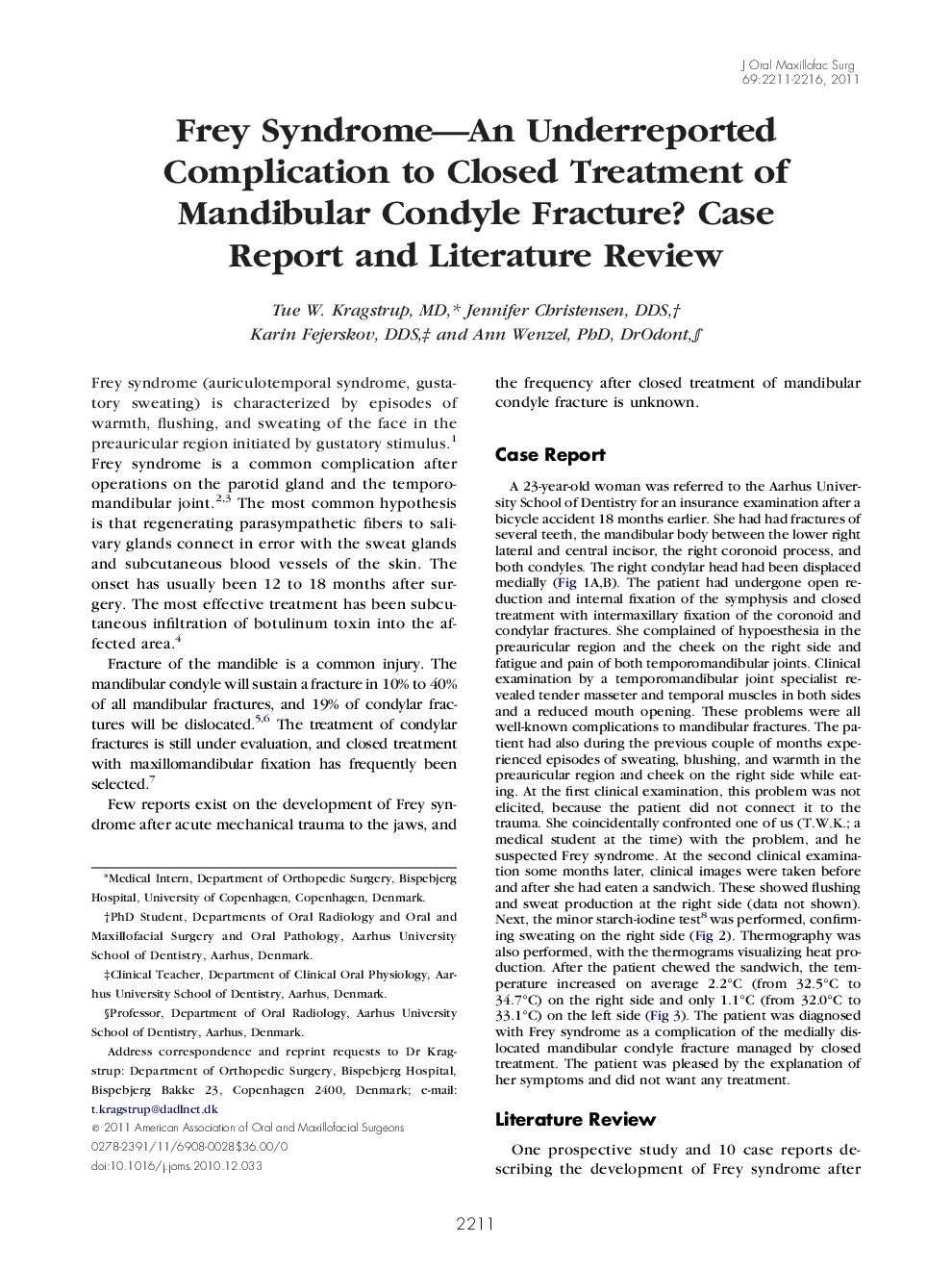 Frey Syndrome-An Underreported Complication to Closed Treatment of Mandibular Condyle Fracture? Case Report and Literature Review