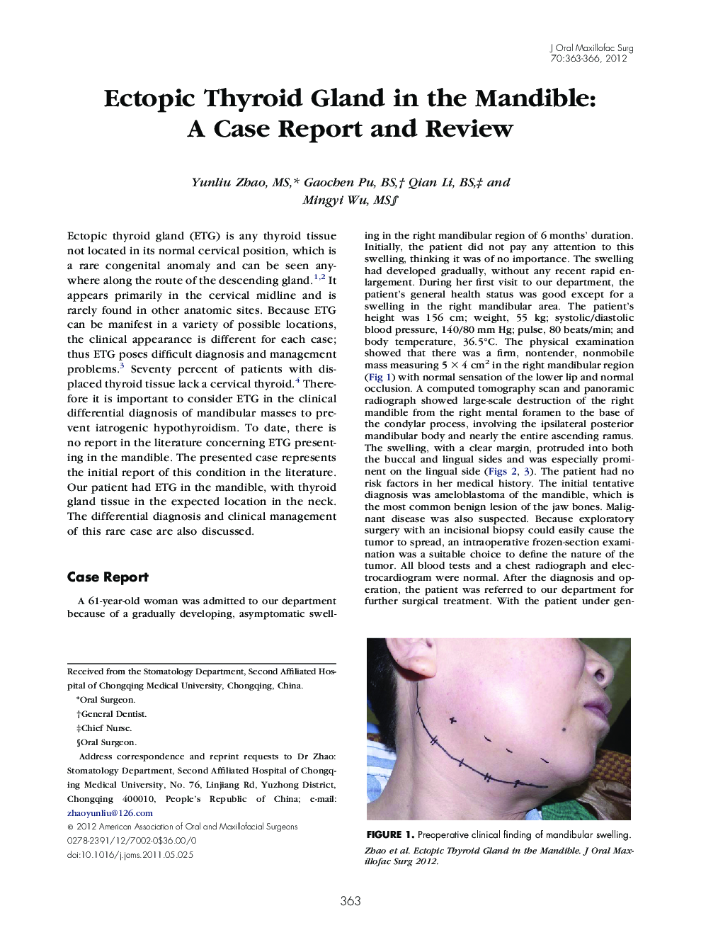 Ectopic Thyroid Gland in the Mandible: A Case Report and Review