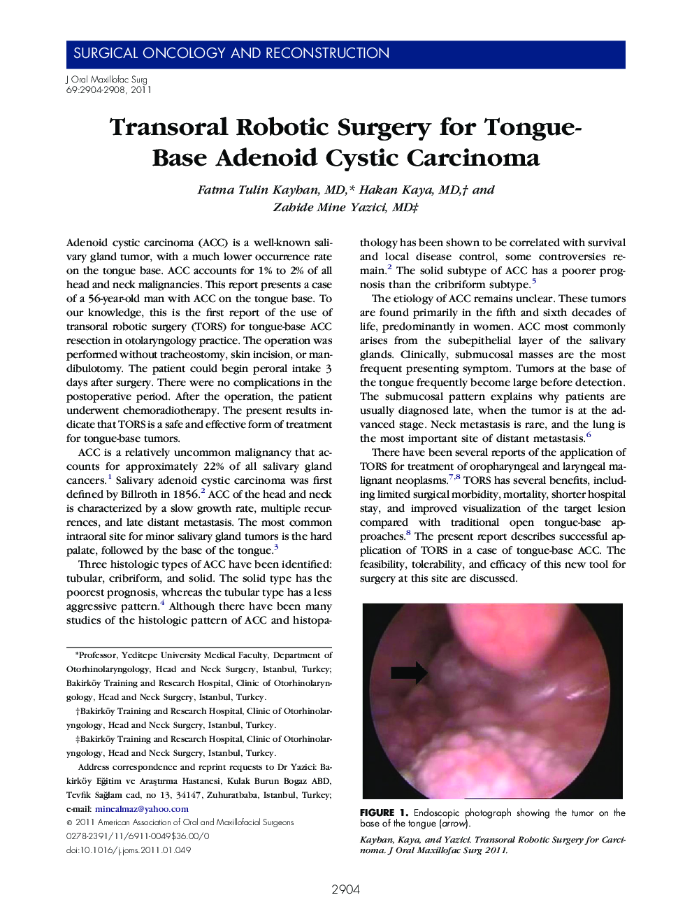 Transoral Robotic Surgery for Tongue-Base Adenoid Cystic Carcinoma