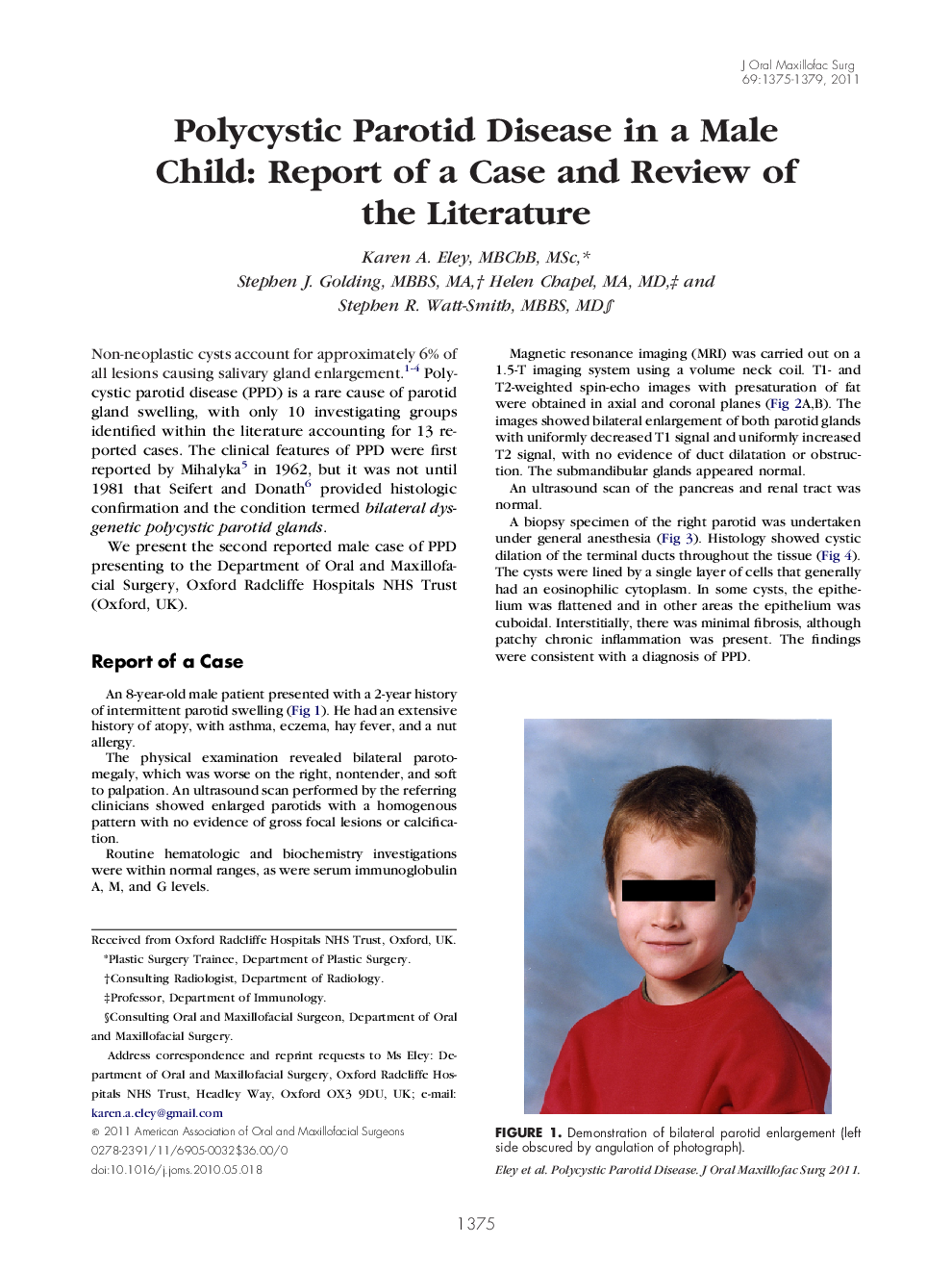 Polycystic Parotid Disease in a Male Child: Report of a Case and Review of the Literature