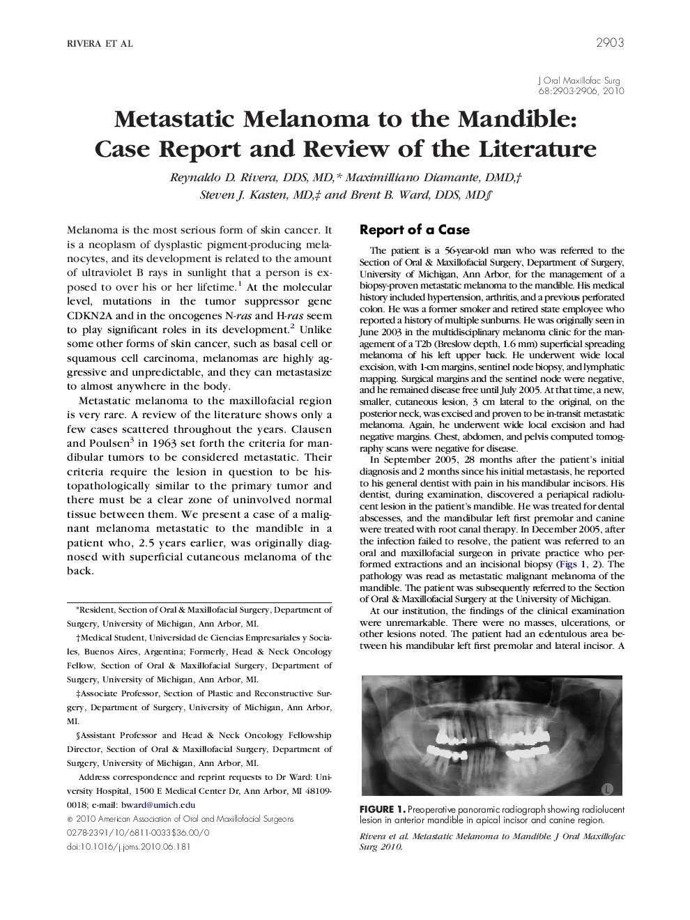 Metastatic Melanoma to the Mandible: Case Report and Review of the Literature