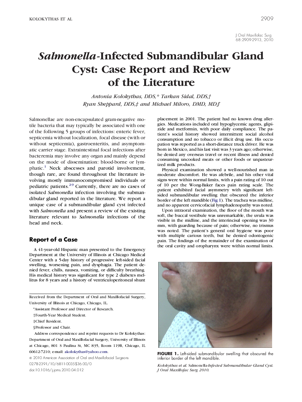 عکس صفحه اول مقاله: Salmonella-Infected Submandibular Gland Cyst: Case Report and Review of the Literature Salmonella-Infected Submandibular Gland Cyst: Case Report and Review of the Literature