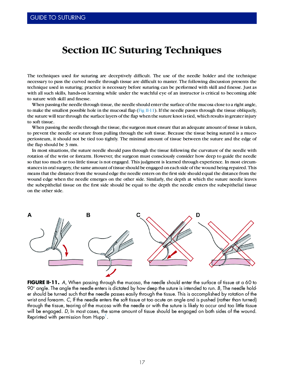 Section IIC Suturing Techniques