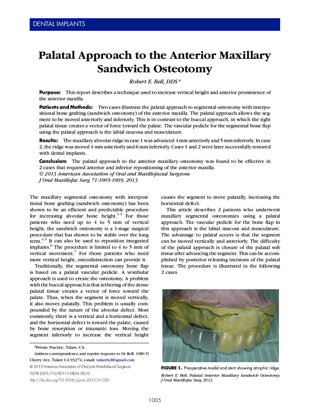 Palatal Approach to the Anterior Maxillary Sandwich Osteotomy