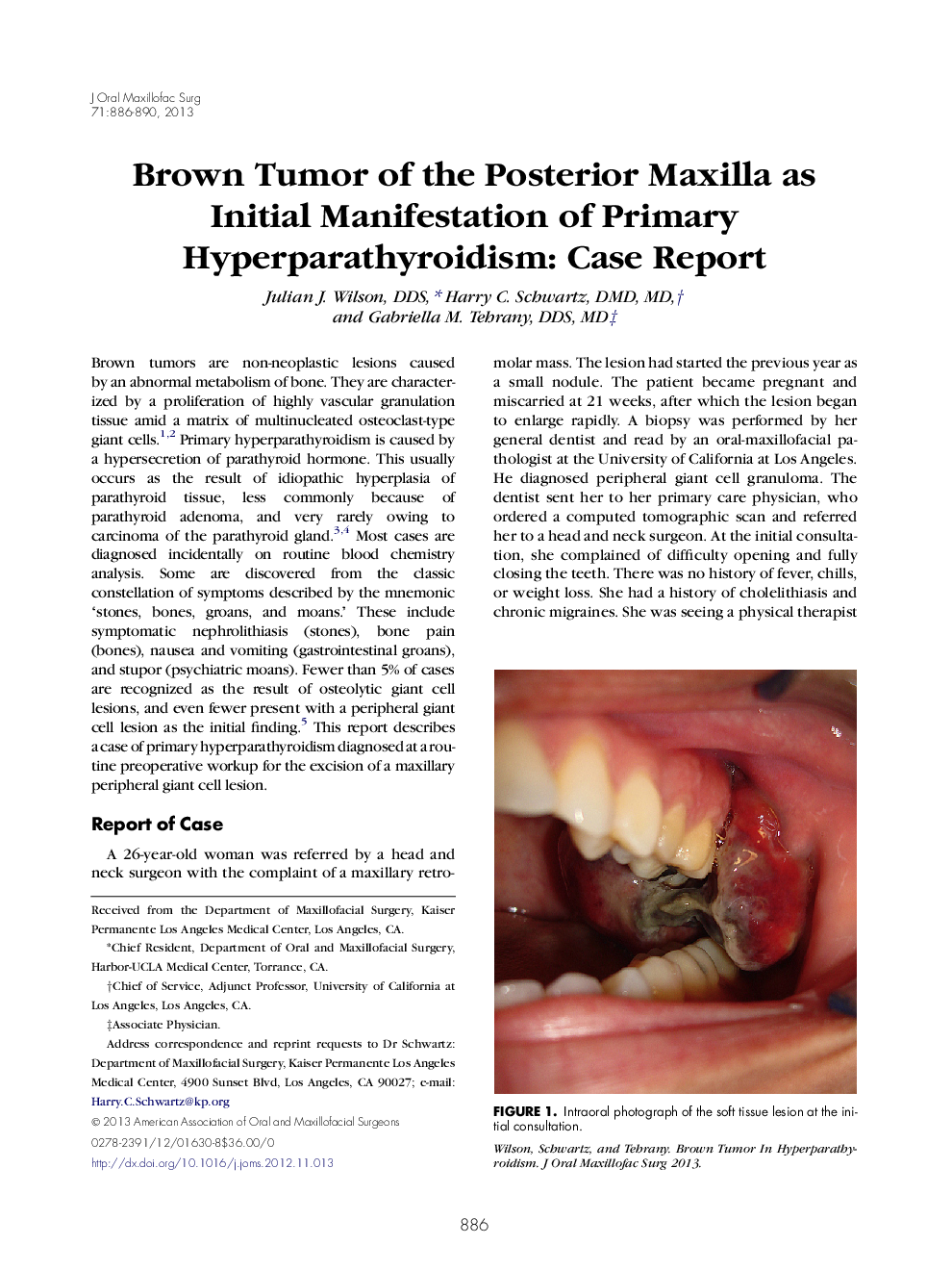 Brown Tumor of the Posterior Maxilla as Initial Manifestation of Primary Hyperparathyroidism: Case Report