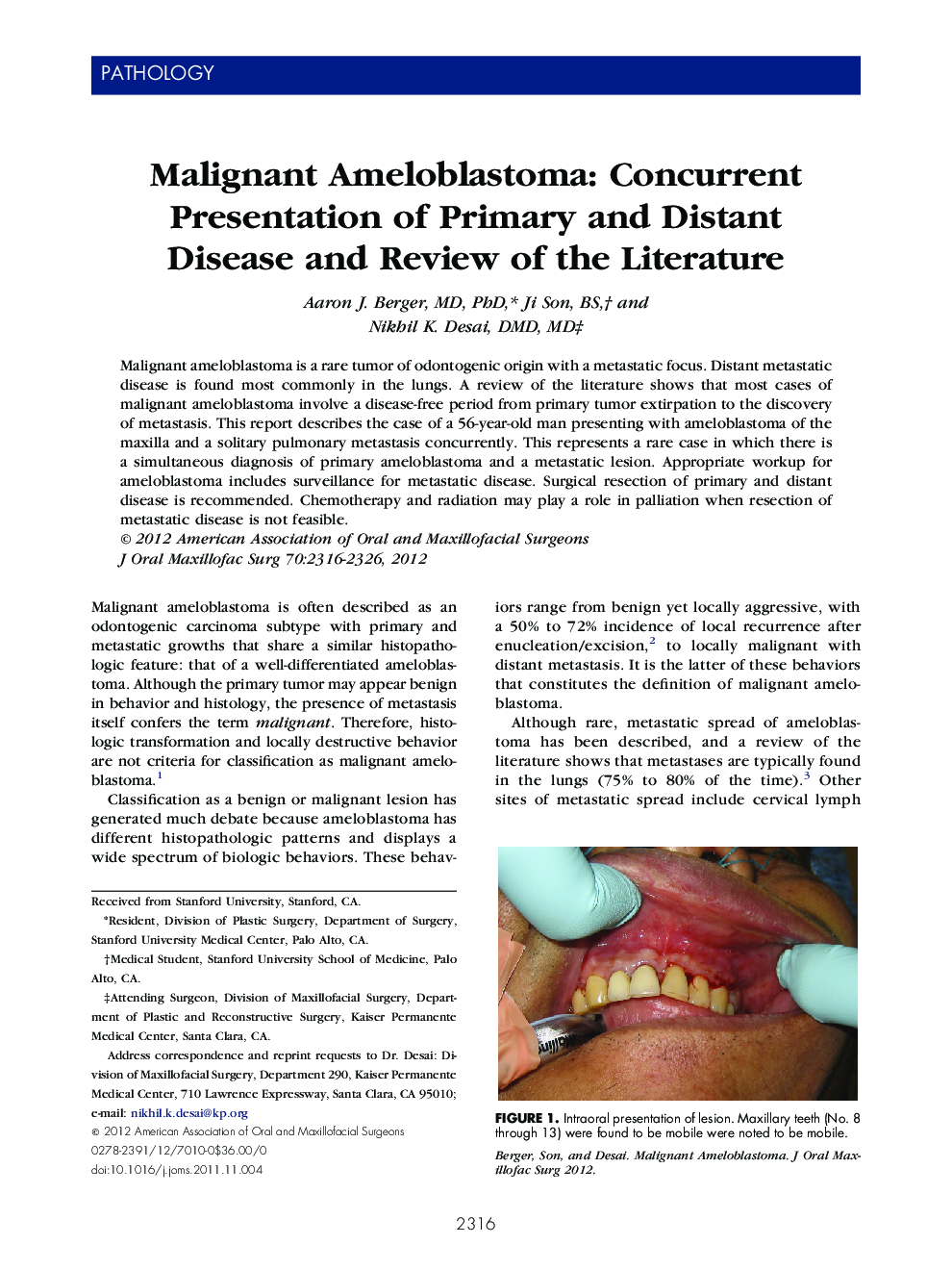 Malignant Ameloblastoma: Concurrent Presentation of Primary and Distant Disease and Review of the Literature