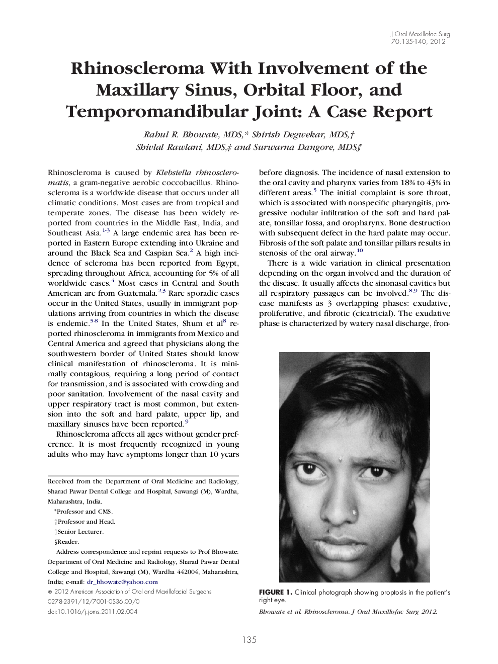 Rhinoscleroma With Involvement of the Maxillary Sinus, Orbital Floor, and Temporomandibular Joint: A Case Report