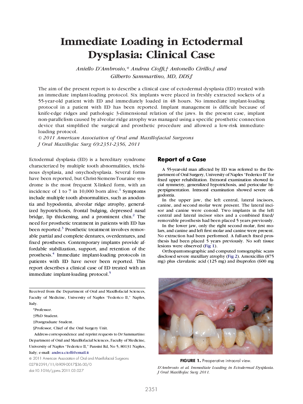 Immediate Loading in Ectodermal Dysplasia: Clinical Case