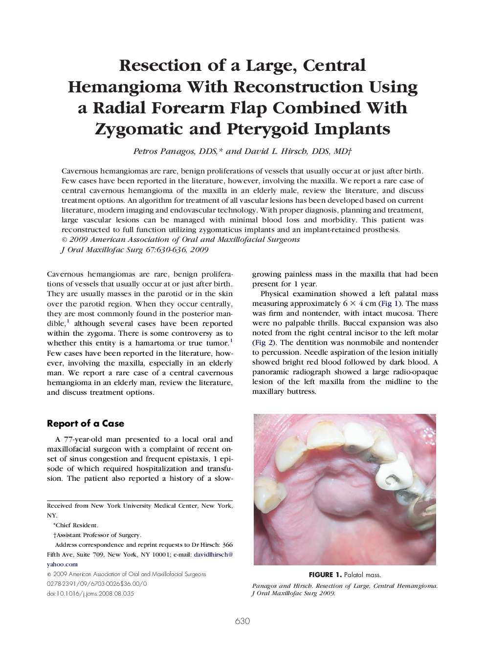 Resection of a Large, Central Hemangioma With Reconstruction Using a Radial Forearm Flap Combined With Zygomatic and Pterygoid Implants