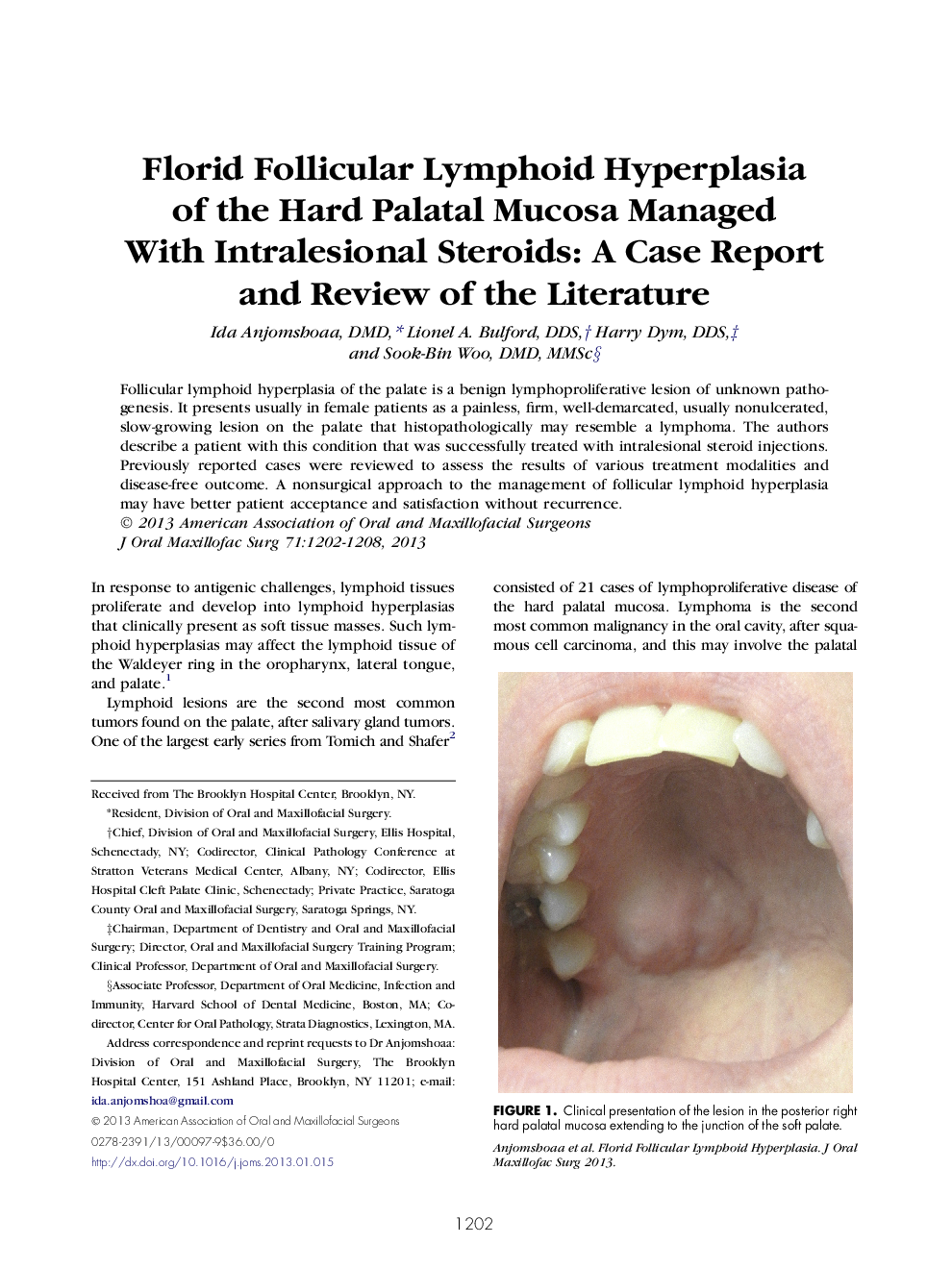 Florid Follicular Lymphoid Hyperplasia of the Hard Palatal Mucosa Managed With Intralesional Steroids: A Case Report and Review of the Literature