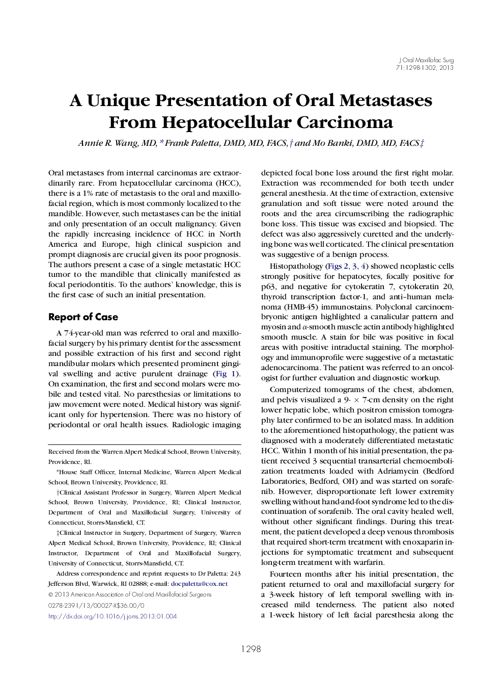 A Unique Presentation of Oral Metastases From Hepatocellular Carcinoma