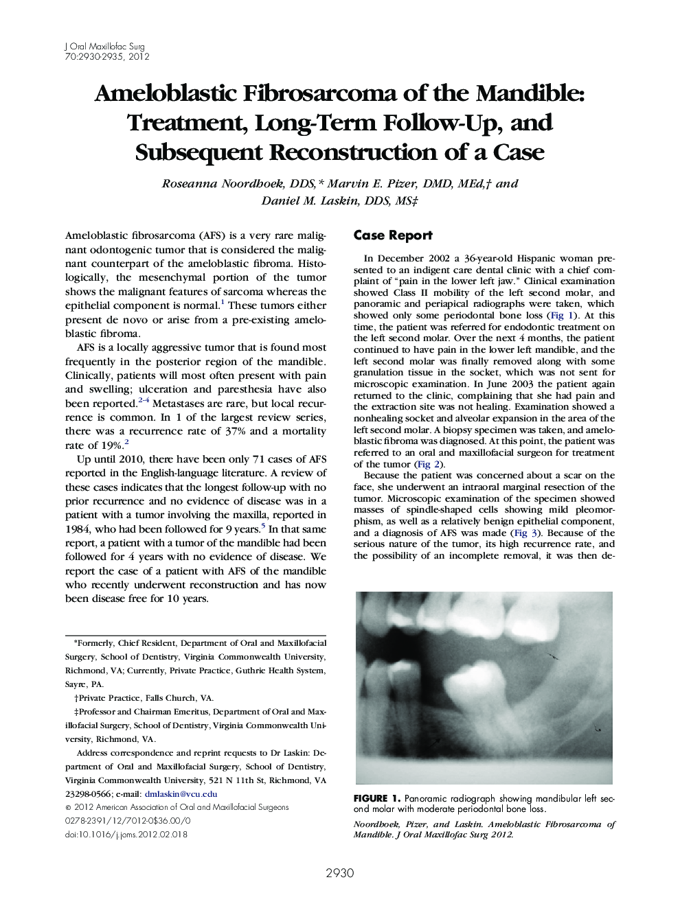 Ameloblastic Fibrosarcoma of the Mandible: Treatment, Long-Term Follow-Up, and Subsequent Reconstruction of a Case