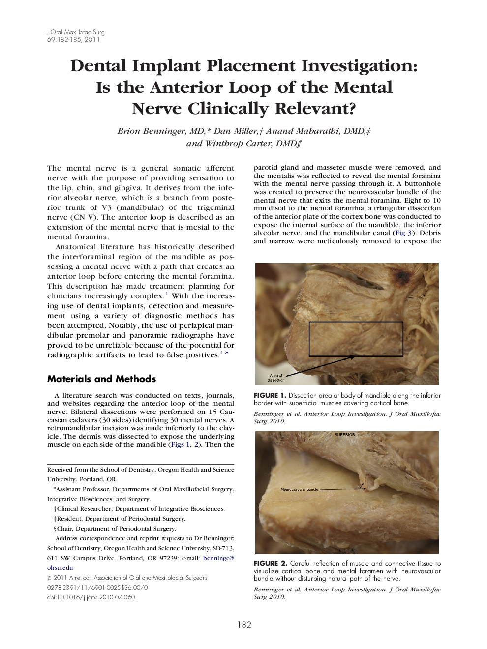 Dental Implant Placement Investigation: Is the Anterior Loop of the Mental Nerve Clinically Relevant?