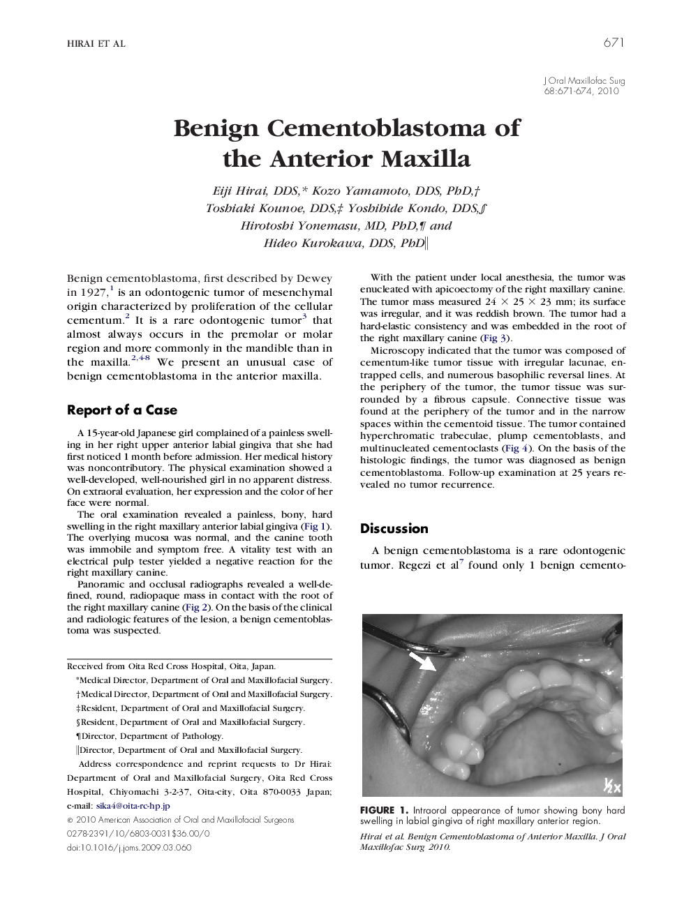 عکس صفحه اول مقاله: Benign Cementoblastoma of the Anterior Maxilla Benign Cementoblastoma of the Anterior Maxilla