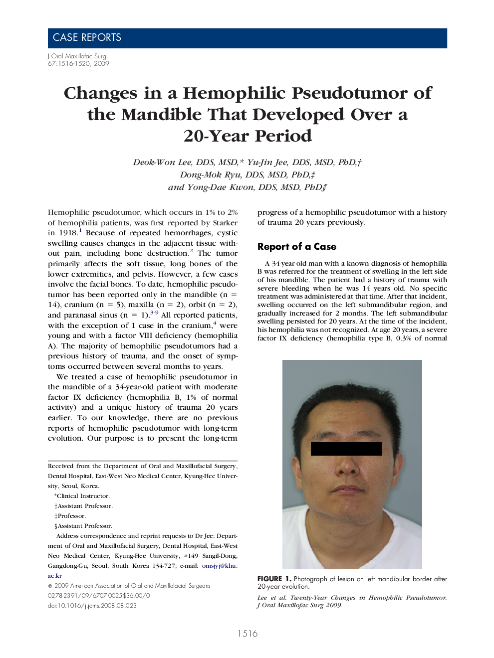 Changes in a Hemophilic Pseudotumor of the Mandible That Developed Over a 20-Year Period