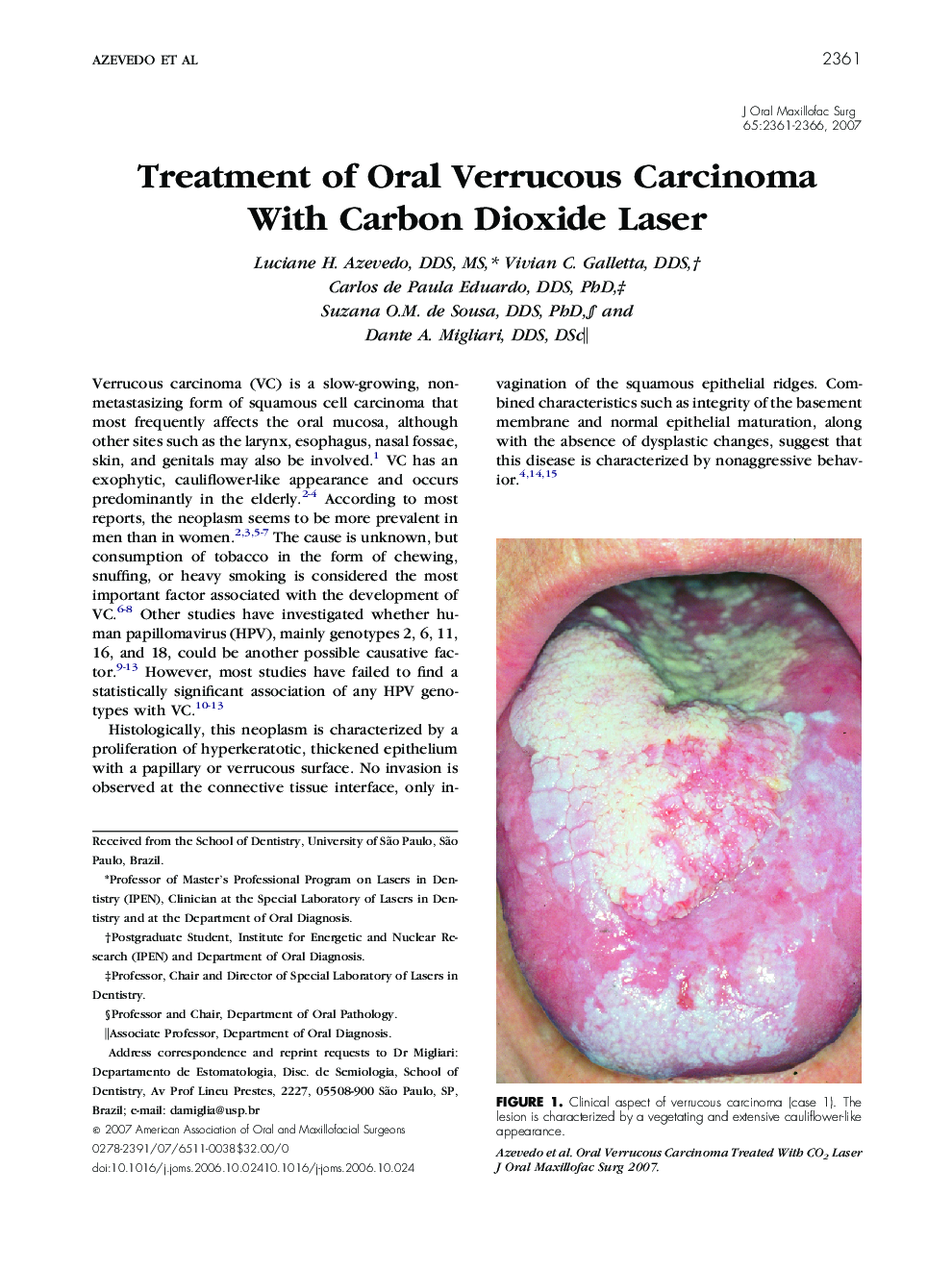 Treatment of Oral Verrucous Carcinoma With Carbon Dioxide Laser