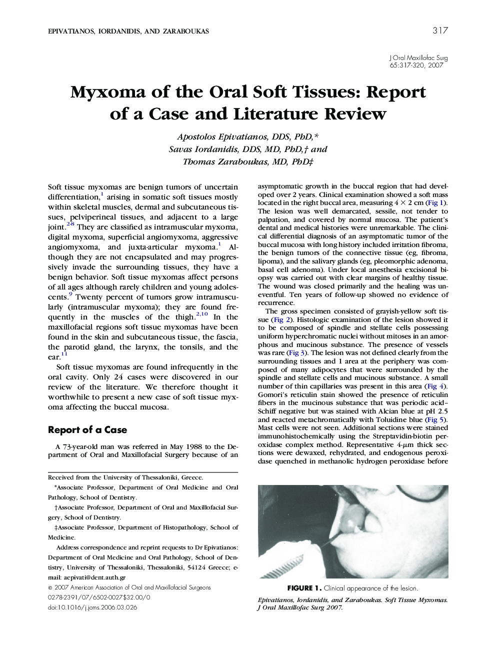 Myxoma of the Oral Soft Tissues: Report of a Case and Literature Review