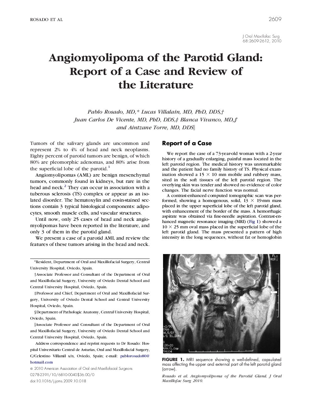 Angiomyolipoma of the Parotid Gland: Report of a Case and Review of the Literature