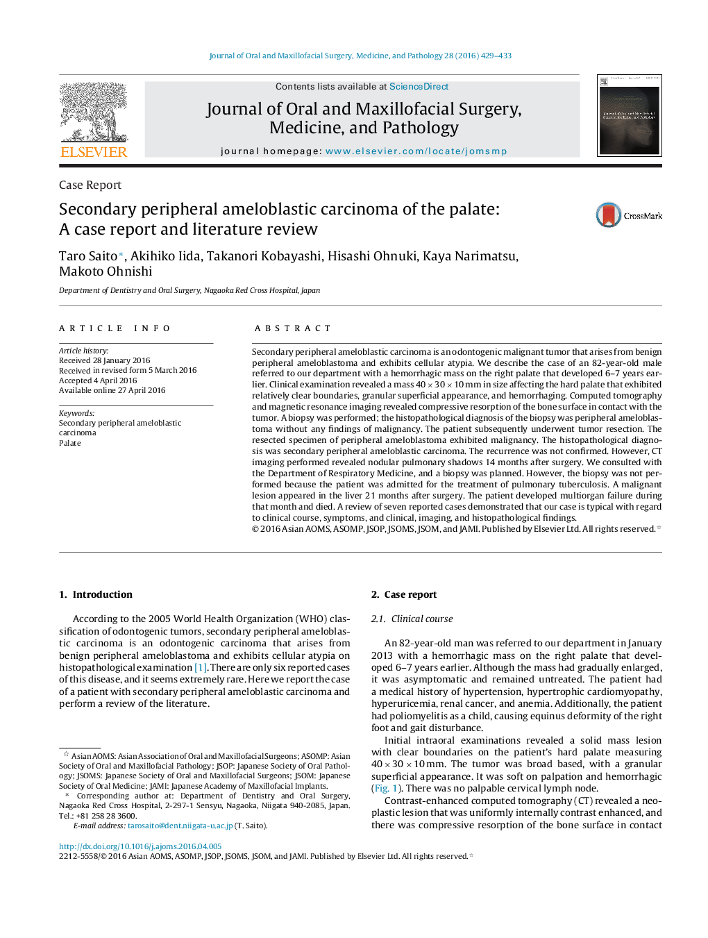 Secondary peripheral ameloblastic carcinoma of the palate: A case report and literature review 