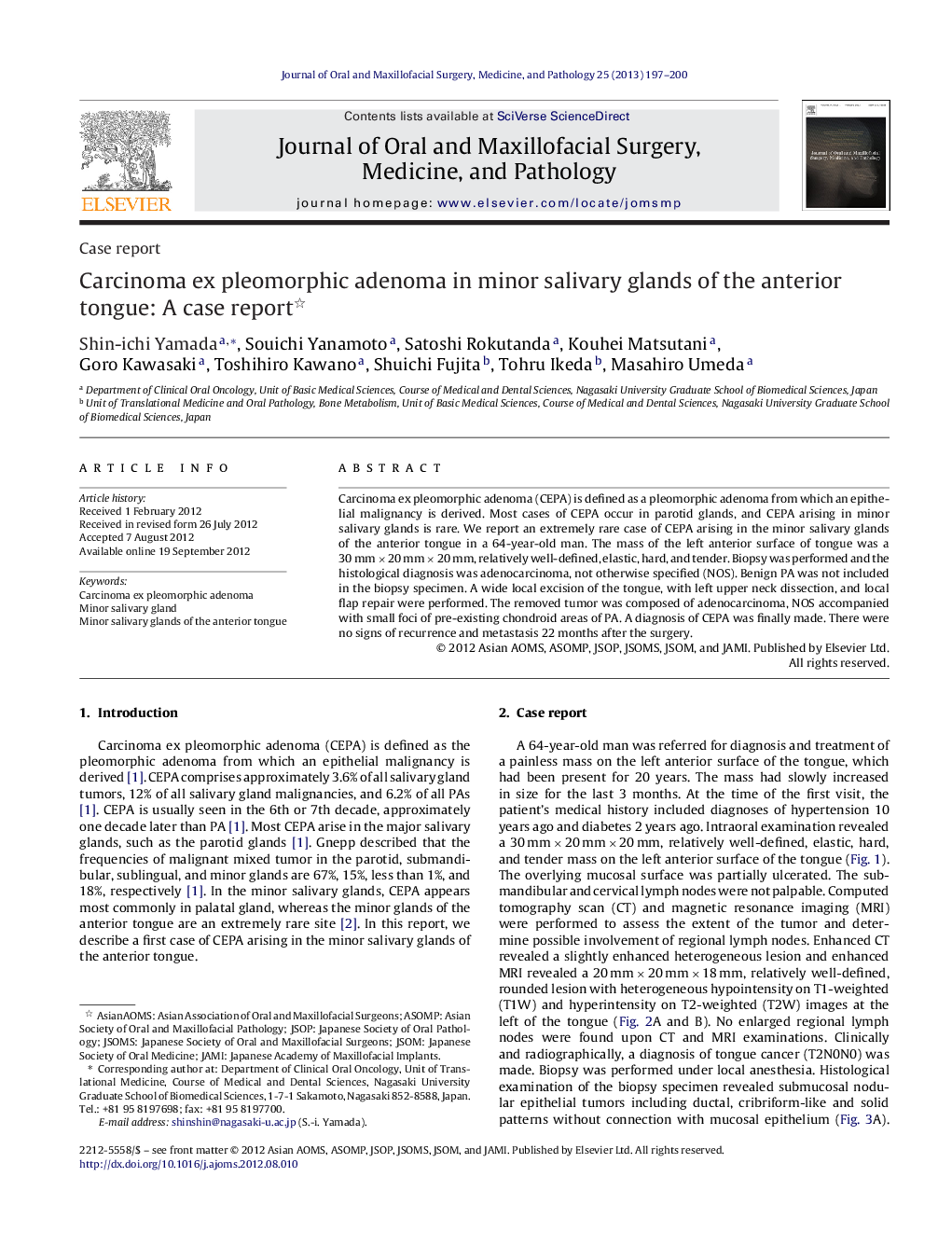 Carcinoma ex pleomorphic adenoma in minor salivary glands of the anterior tongue: A case report