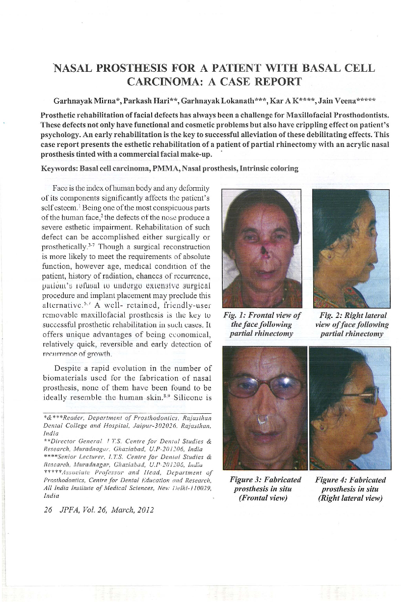 Nasal prosthesis for a patient with basal cell carcinoma: A case report