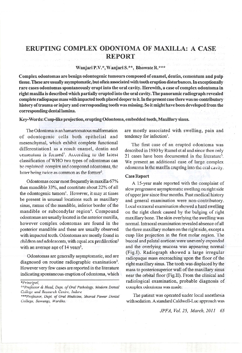 Erupting complex odontoma of maxilla: A case report