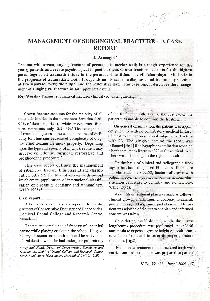 Management of subgingival fracture - A case report