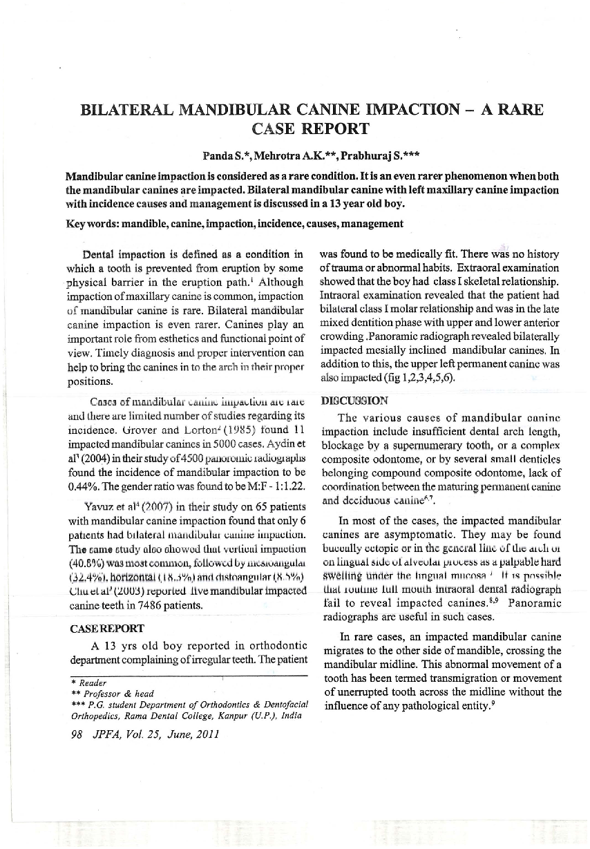 Bilateral mandibular canine impaction – a rare case report