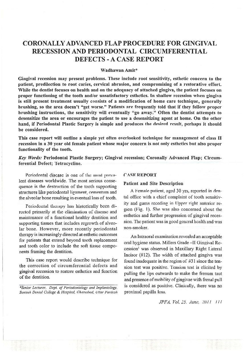 Coronally advanced flap procedure for gingival recession and periodontal circumferential defects - a case report