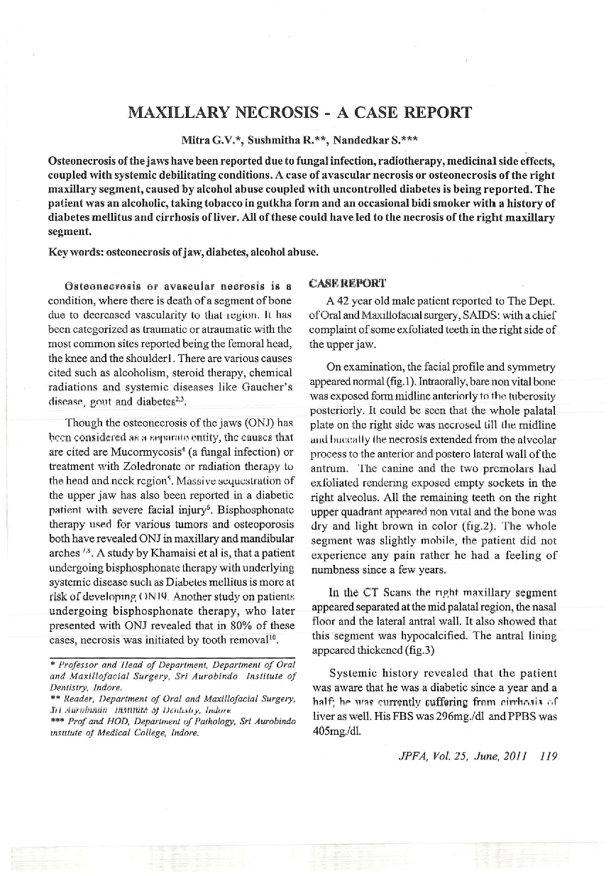 Maxillary necrosis - a case report