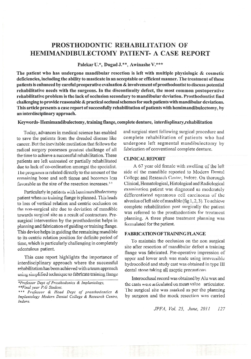 Prosthodontic rehabilitation of hemimandibulectomy patient- a case report