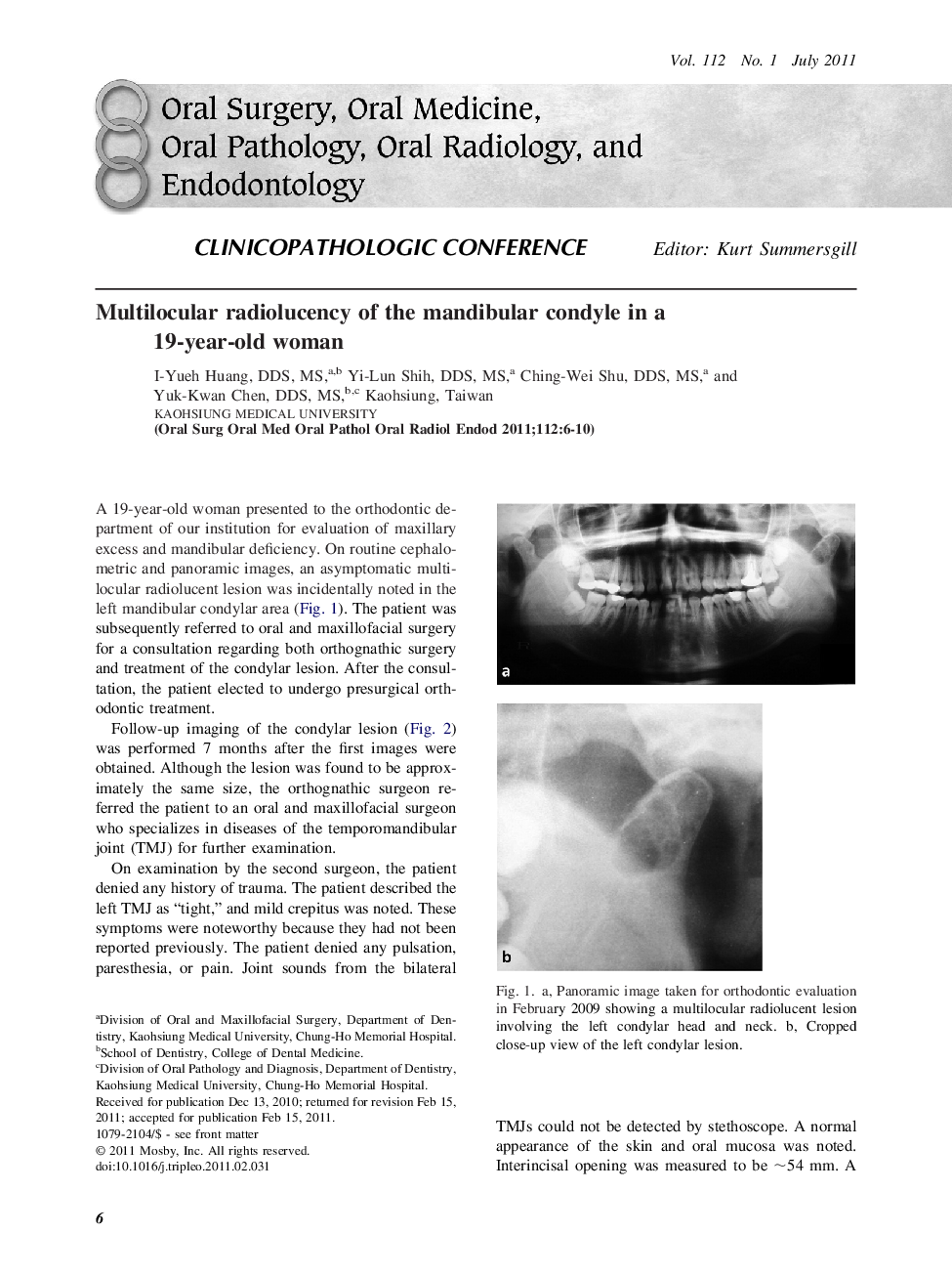 Multilocular radiolucency of the mandibular condyle in a 19-year-old woman