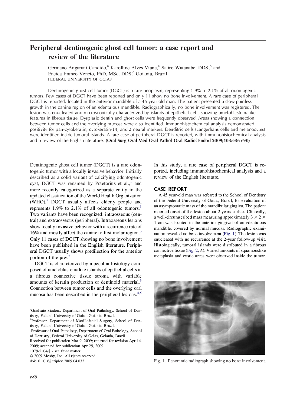 Peripheral dentinogenic ghost cell tumor: a case report and review of the literature