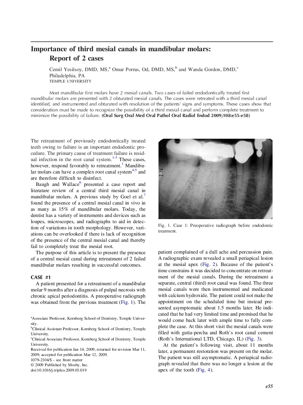 Importance of third mesial canals in mandibular molars: Report of 2 cases