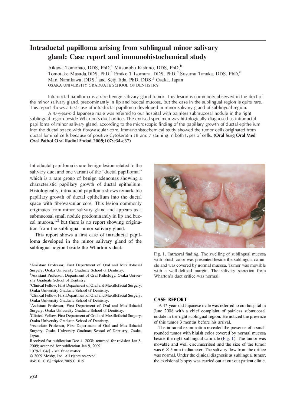 Intraductal papilloma arising from sublingual minor salivary gland: Case report and immunohistochemical study