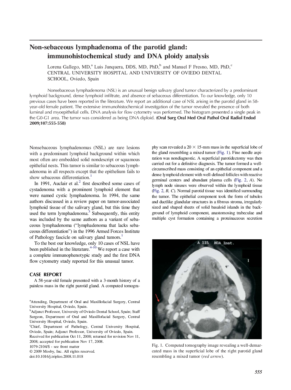 Non-sebaceous lymphadenoma of the parotid gland: immunohistochemical study and DNA ploidy analysis