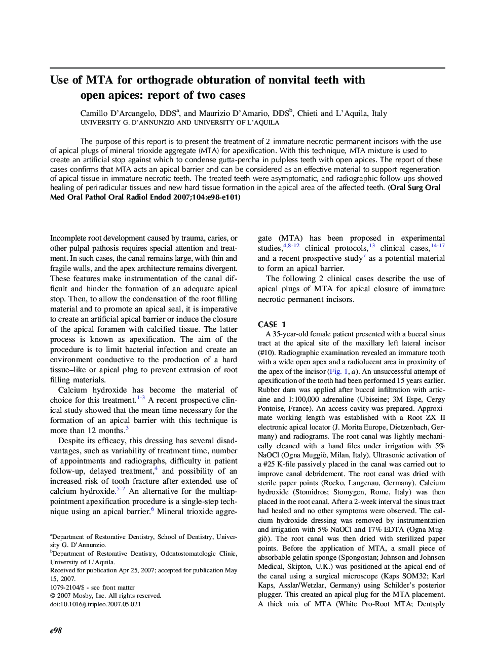 Use of MTA for orthograde obturation of nonvital teeth with open apices: report of two cases