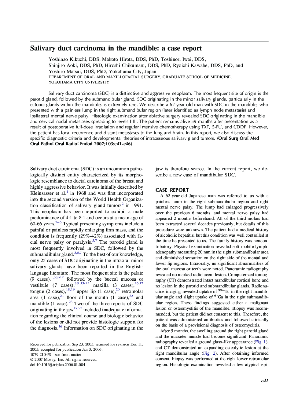 Salivary duct carcinoma in the mandible: a case report