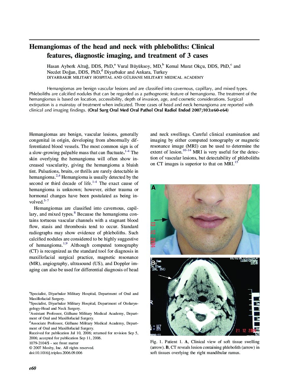 Hemangiomas of the head and neck with phleboliths: Clinical features, diagnostic imaging, and treatment of 3 cases