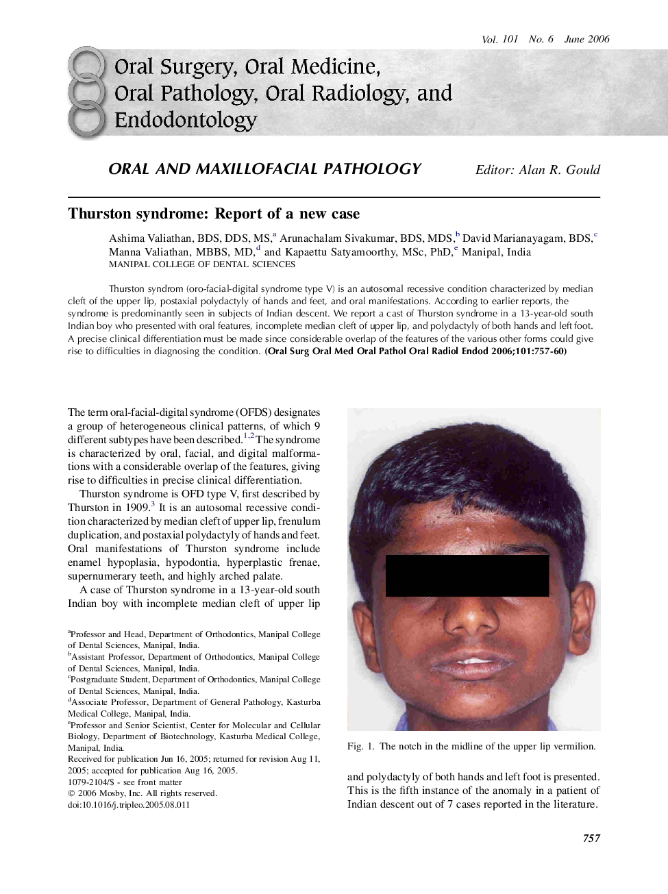 Thurston syndrome: Report of a new case