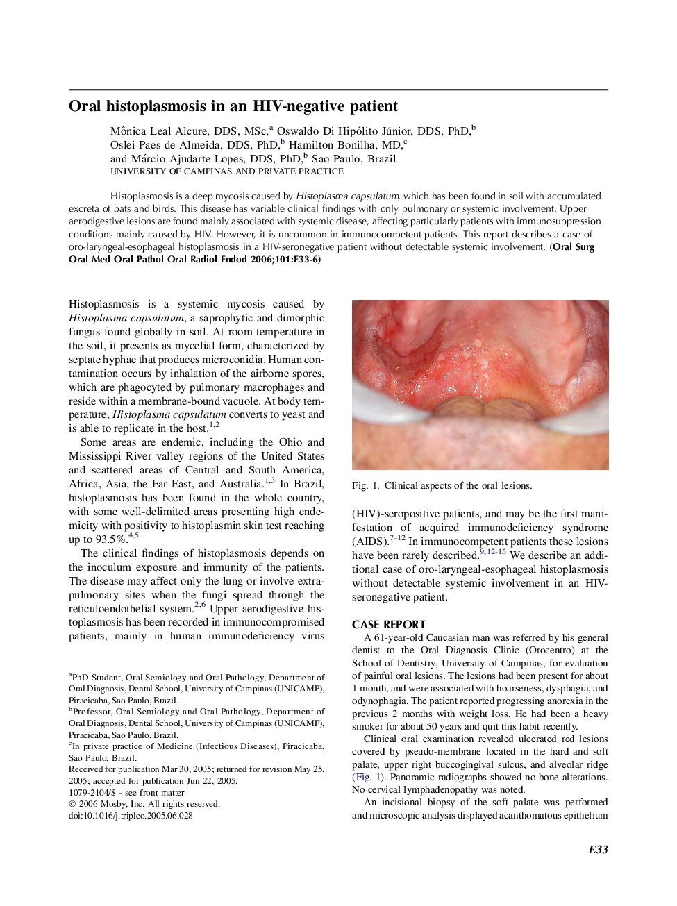Oral histoplasmosis in an HIV-negative patient